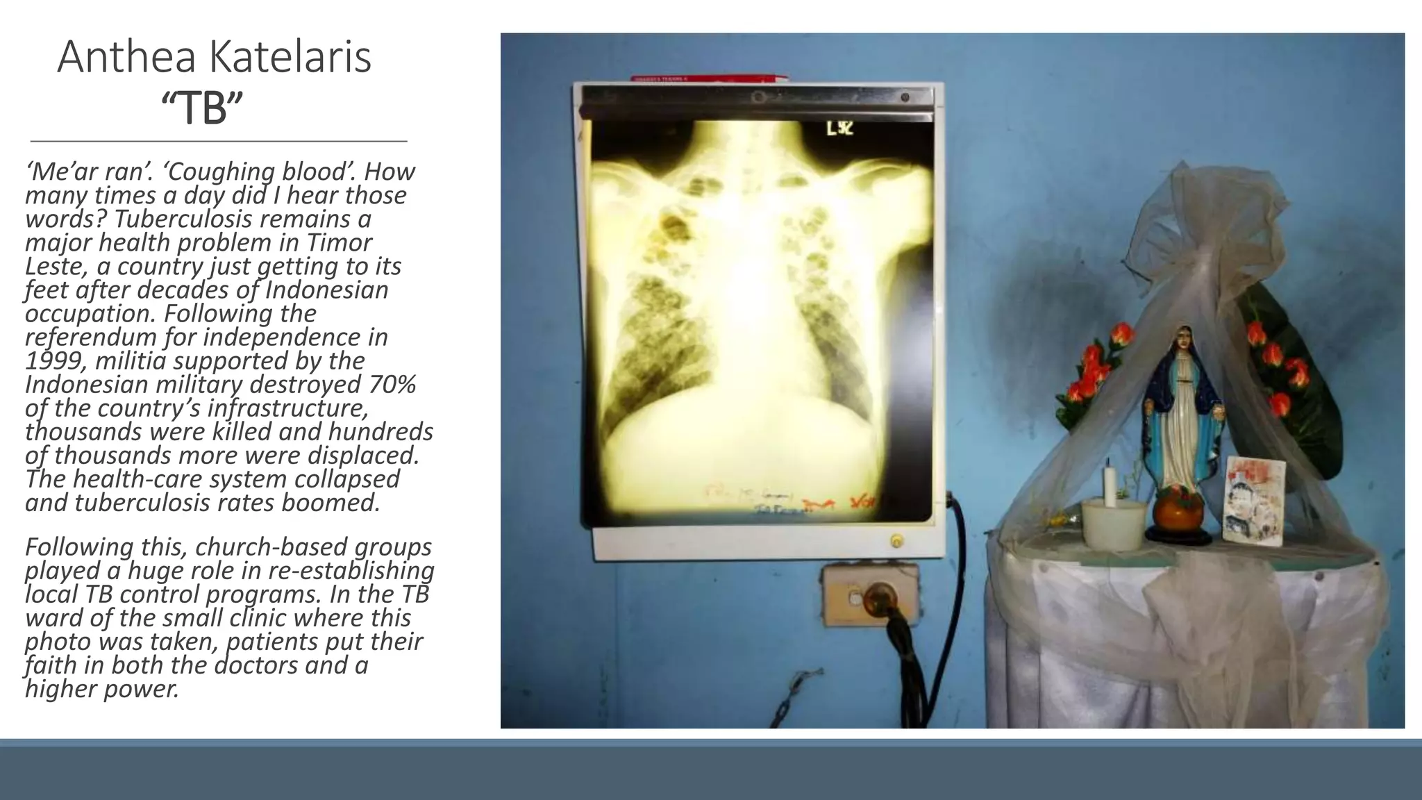 Anthea Katelaris
“TB”
‘Me’ar ran’. ‘Coughing blood’. How
many times a day did I hear those
words? Tuberculosis remains a
major health problem in Timor
Leste, a country just getting to its
feet after decades of Indonesian
occupation. Following the
referendum for independence in
1999, militia supported by the
Indonesian military destroyed 70%
of the country’s infrastructure,
thousands were killed and hundreds
of thousands more were displaced.
The health-care system collapsed
and tuberculosis rates boomed.
Following this, church-based groups
played a huge role in re-establishing
local TB control programs. In the TB
ward of the small clinic where this
photo was taken, patients put their
faith in both the doctors and a
higher power.
 