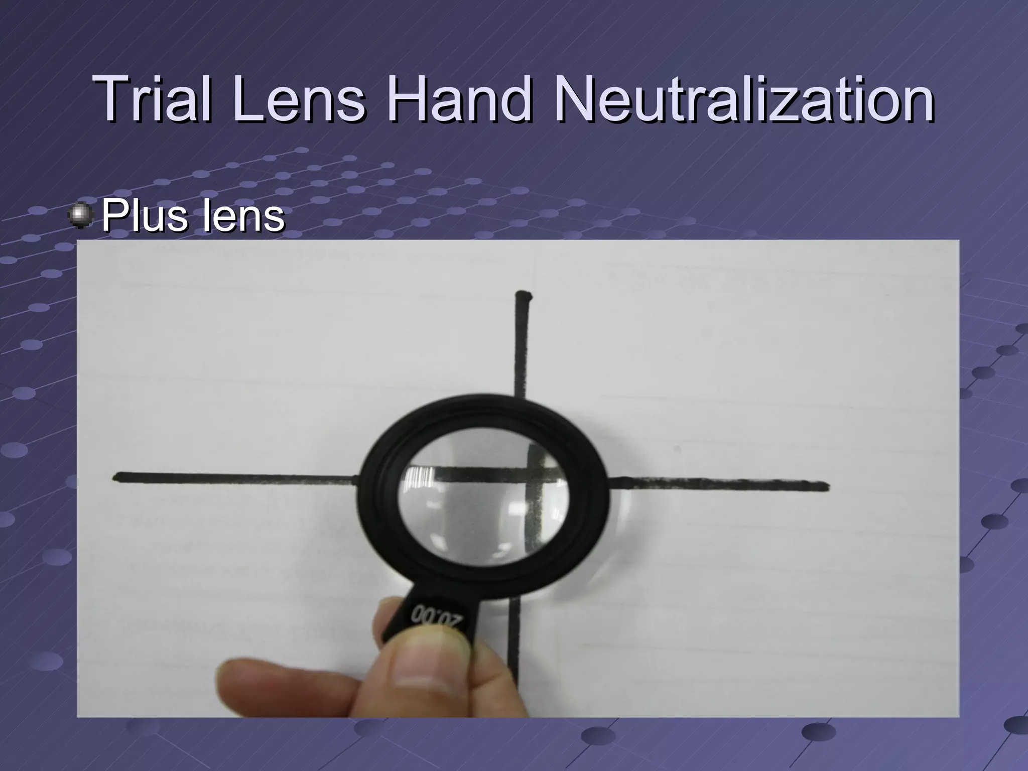 Trial Lens Hand Neutralization
Plus lens
 