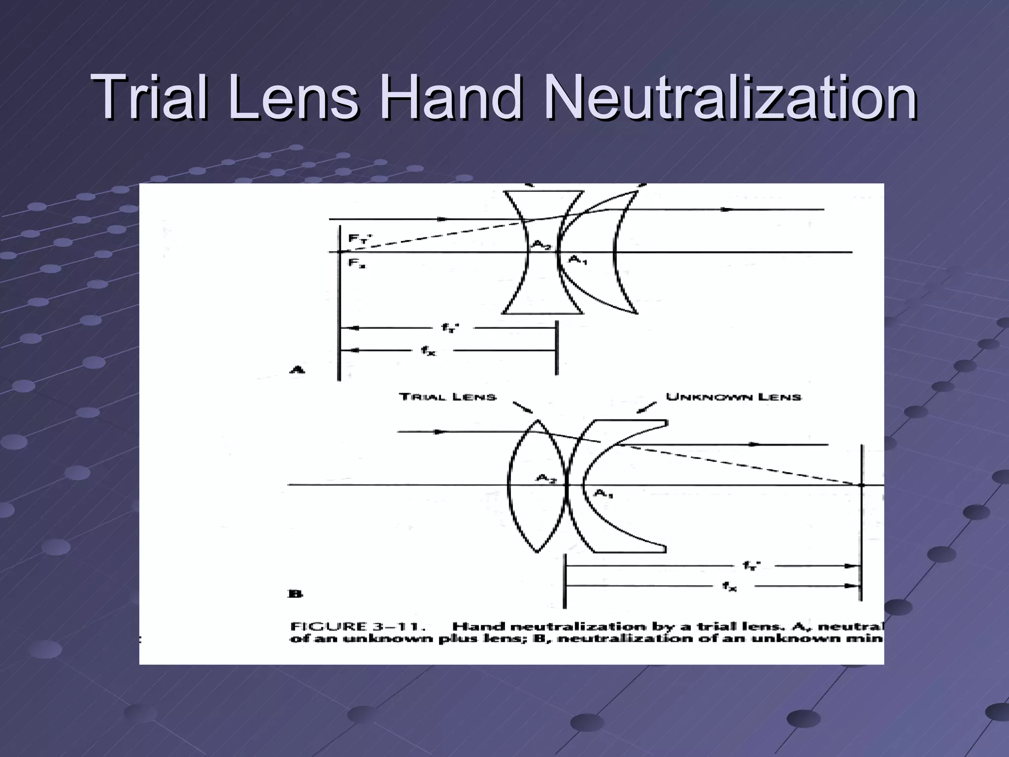 Trial Lens Hand Neutralization
 