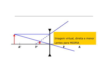 F’ F A A’ Imagem virtual, direita e menor Lentes para MIOPIA 