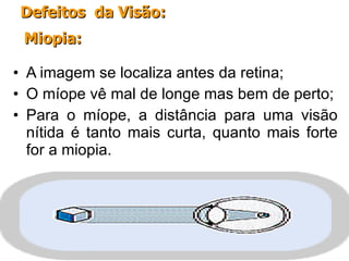 A imagem se localiza antes da retina; O míope vê mal de longe mas bem de perto; Para o míope, a distância para uma visão nítida é tanto mais curta, quanto mais forte for a miopia. Defeitos  da Visão: Miopia: 