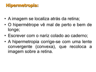 A imagem se localiza atrás da retina; O hipermétrope vê mal de perto e bem de longe; Escrever com o nariz colado ao caderno; A hipermetropia corrige-se com uma lente convergente (convexa), que recoloca a imagem sobre a retina. Hipermetropia: 