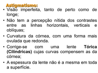 Visão imperfeita, tanto de perto como de longe; Não tem a percepção nítida dos contrastes entre as linhas horizontais, verticais e oblíquas; Curvatura da córnea, com uma forma mais ovulada que redonda. Corrige-se com uma lente  Tórica (Cilíndricas)  cujas curvas compensem as da córnea; A espessura da lente não é a mesma em toda a superfície. Astigmatismo: 