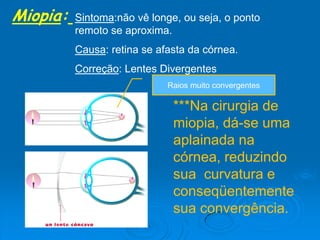 Miopia: Sintoma:não vê longe, ou seja, o ponto
remoto se aproxima.
Causa: retina se afasta da córnea.
Correção: Lentes Divergentes
***Na cirurgia de
miopia, dá-se uma
aplainada na
córnea, reduzindo
sua curvatura e
conseqüentemente
sua convergência.
Raios muito convergentes
 
