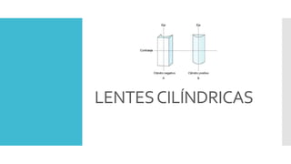 LENTESCILÍNDRICAS
 