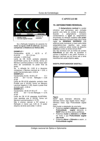 Curso de Contatologia
Colégio nacional de Óptica e Optometria
39
Se a Refração Subjetiva do paciente for
maior ou igual a 4,00 di esféricas, devemos
compensar a Distância ao Vértice (DV).
EXEMPLO 1
Ceratometria 42.50 / 42.75 a 0
o
.
K=42.50 DV =12 mm
refração = -3,00 di esf
Lente de CB 43.00, portanto adaptada
AJUSTADA acima de K (42.50), forma um
Menisco Lacrimal positivo (+ 0,50. Esse valor
deve ser considerado no poder final da
lente).
Se a refração for –3,00 di e devemos
compensar o Menisco lacrimal de + 0,50, o
poder final da lente será –3,50 di.
EXEMPLO 2
Ceratometria 43.00 / 43.50 a 0
o
. K =
43.00 DV = 12 mm Refração = - 3,00
di esf
Lente de CB 42.00 adaptada, portanto mais
PLANA que K (43.00), forma um Menisco
Lacrimal negativo (-1,00) .Assim o poder final
da lente será – 2.00 di.
EXEMPLO 3
Ceratometria 40.50 /41.50 a 0
o
. K =
40.50 DV = 12 mm Refração = + 3,75
di esf.
Lente de CB 41.25 adaptada AJUSTADA,
mais apertada que K (40.50), forma um
Menisco Lacrimal positivo (+ 0,75) .
Não é preciso calcular a DV porque a
Refração é menor que 4,00 di. O poder
dióptrico da lente será então + 3,00 di.
CAPITULO III
15- ASTIGMATISMO RESIDUAL
O Astigmatismo residual é o poder
cilíndrico que permanece sem correção
quando uma lente de contato é adaptada.
Quando o astigmatismo corneano
(ceratométrico) é igual ao astigmatismo
encontrado na refração subjetiva (em poder
e eixo) o Menisco Lacrimal criado sob a lente
rígida de DESENHO ESFÉRICO (CB
esférica) pode neutralizar a maior parte deste
astigmatismo.Isso significa que quase
sempre podemos utilizar lentes de desenho
esférico e evitar as lentes tóricas RGP.
Isto não acontece com as lentes de contato
Hidrofílicas já que elas se amoldam à
córnea e adquirem o seu perfil. Portanto, o
Menisco Lacrimal que se forma sob a lente
hidrofílica tem poder dióptrico zero.
SAGITA (PROFUNDIDADE SAGITAL) :
Figura
RZOP igual, Diâmetro diferente. Azul:
diâmetro menor, logo Sagita menor. Negro :
diâmetro maior, logo Profundidade sagital
maior.
Para mudar a adaptação de uma lente :
 Podemos manter o diâmetro e mudar a
Profundidade sagital alterando a
RZOP (Raio da Zona óptica periférica).
 Podemos mudar o diâmetro e a RZOP
de modo a que Profundidade sagital
não mude .
 Podemos alterar o Diâmetro e assim , a
Profundidade sagital.
Fisiologia da
adaptação
 