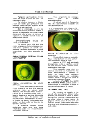 Curso de Contatologia
Colégio nacional de Óptica e Optometria
46
A pálpebra superior pode ser elevada
acima da borda superior da lente por
manipulação digital.
As pálpebras superiores e inferior
podem ser usadas pelo profissional para
manipular a lente de forma a permitir a sua
centralização sobre a córnea.
Com a centralização, o padrão de
fluoresceína deve ser avaliado e anotado.O
acúmulo de fluoresceína indica uma zona de
afastamento entre a lente e a córnea e a
espessura da camada lacrimal abaixo da
lente pode ser avaliada.
- CARACTERÍSTICAS IDEAIS DA
ADAPTAÇÃO ESTÁTICA
Em muitos casos, uma lente que
mostra um pequeno afastamento apical, com
zona média -periférica de contato leve,
amplitude e suficiente afastamento de borda
,proporcionará uma ótima adaptação de
RGP.
-CARACTERÍSTICAS ESTÁTICAS DE UMA
LENTE AJUSTADA
FIGURA: FLUOROGRAMA DE LENTE
AJUSTADA
O padrão de fluoresceína associado
a uma adaptação de lente RGP ajustada
geralmente mostra um acúmulo apical
indicando uma claridade central excessiva.
Como o RZOP está menor (mais curvo), o
grau de afastamento aumenta. Isto resulta
também numa zona de contato mais
profunda na zona médio-periférica da córnea.
O excesso de pressão nesta região pode
resultar em deformação ou distorção da
topografia corneana.
A aparência periférica mostra
ajustamento assim como uma borda
estreita.Este quadro pode ser descrito como
uma periferia “ajustada”.
Cada componente da adaptação
estática pode ser avaliado
independentemente.
O acúmulo central de fluoresceína
não está necessariamente associado com
uma periferia ajustada.
- CARACTERÍSTICAS ESTÁTICAS DE UMA
LENTE FROUXA
FIGURA: FLUOROGRAMA DE LENTE
APLANADA
Uma tendência para uma adaptação
frouxa será evidente em uma lente que tem
uma limitada zona central de toque.
Quando a RZOP está aumentada
(mais plana), o centro da superfície posterior
da lente descansa contra a córnea central,
relativamente mais curva.
Uma adaptação frouxa mostra um
acúmulo excessivo de fluoresceína nas
zonas médio-periférica e periférica.Tais
lentes, em muitos casos, mostraram
características pobres de adaptação
dinâmica devido à redução nas forças de
centralização que atuam na lente.
A tabela AVALIAÇÃO DA LENTE
DE CONTATO RÍGIDA poderá ajudar a
avaliar melhor o Fluorograma e decidir os
parâmetros finais da lente de contato.
21.2- REMOÇÃO DA LENTE
No momento da retirada, a LC
deverá estar centralizada. Existem muitas
técnicas para remover as lentes. A menos
traumatizante é mandar o paciente abrir bem
os olhos, esticar o ângulo externo da
pálpebra e tentar piscar. A lente pode sair
com uma piscada forte ou sendo empurrada
a partir da borda da pálpebra superior com o
dedo médio.
 