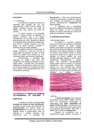 Curso de Contatologia
Colégio nacional de Óptica e Optometria
5
E:Endotélio
1.1.1- EPITÉLIO
A existência do Epitélio Corneano foi
reportada pela primeira vez por Van
Leeeuwenhock (1693-1718).As células do
epitélio corneano formam uma linha de
defesa para todo usuário de lentes de
contato.
A córnea começa a sua formação
durante a quinta semana de gestação. O
estroma corneano, que é de origem
mesodérmica, em sua fase inicial é coberto
anteriormente por duas camadas de células
do ectoderma.Estas camadas se diferenciam
para formar o epitélio corneano. Aos três
meses, as fibras nervosas começam a
aparecer entre as células epiteliais.
O epitélio corneano é continuação do
epitélio conjuntival, o qual por sua vez é
continuação da epiderme da pele. O limite
interno do epitélio está formado por uma
membrana basal, que também é sintetizada.
Externamente, a atmosfera está
separada do epitélio pelo filme pré-
corneal.Fora da espessura periférica e até a
região limbar , o epitélio tem uma estrutura
multicelular marcadamente uniforme de 50 a
60 micras de espessura. Considera-se então
que o epitélio ocupa aproximadamente 10 %
da espessura corneana.
Fig.2:EPITÉLIO E CAMADA DE BOWMAN
Fig.3:MEMBRANA DE DESCEMET E
.
ENDOTÉLIO
O epitélio é formado por cinco a seis
camadas de células do tipo estratificado.
O epitélio corneano pode ser observado em
biomicroscopia em secção óptica ou
paralelepípedo.Ele é visto como uma linha
delgada sendo a diferenciação entre as
lágrimas e o epitélio corneano mais
evidenciada com a aplicação de
fluoresceína e o filtro azul cobalto.Quando
há alguma interrupção do epitélio se observa
uma variação da espessura da película
lacrimal, observando-se o tingimento das
células lesadas.
É importante que o contatólogo
examine o epitélio dos pacientes usuários de
lentes de contato, já que as primeiras
reações corneanas adversas em usuários de
lentes se manifestam no epitélio.
A- FUNÇÕES DO EPITÉLIO
- PROTEÇÃO FÍSICA
O epitélio é a estrutura corneana
mais externa e tem que proteger as delicadas
estruturas internas, as quais, quando
lesadas, não podem se reproduzir. O epitélio
não somente oferece resistência aos corpos
estranhos como objetos voadores ou lentes
de contato como também resiste à fricção
continua do piscar ou os rigores do ato de
esfregar os olhos.O epitélio tem uma
natureza altamente elástica a danos físicos
significantes. Adicionalmente o epitélio
possui uma excelente reprodutibilidade.
Então quando sofre um trauma, se recupera
rapidamente. Esta recuperação acontece
primeiro por uma migração das células
existentes que cobrem a área lesada e em
seguida por uma reprodução acelerada para
substituir as células perdidas.
- ÓPTICA
O Índice de refração varia, segundo
as pesquisas, entre 1.375 e 1.543. A córnea,
como foi mencionada previamente, é
responsável pela maior quantidade de
poder refrativo do olho e o epitélio tem que
manter sua uniformidade para proporcionar
uma superfície óptica perfeita. Além disto, o
epitélio deve manter-se transparente.
Quando há problemas com a
transparência desta camada corneana, a
 