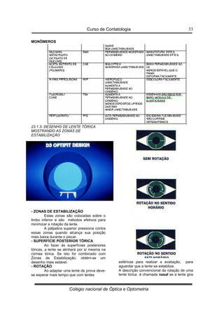 Curso de Contatologia
Colégio nacional de Óptica e Optometria
53
MONÔMEROS
23.1.3- DESENHO DE LENTE TÓRICA
MOSTRANDO AS ZONAS DE
ESTABILIZAÇÃO
- ZONAS DE ESTABILIZAÇÃO
Estas zonas são colocadas sobre o
limbo inferior e são métodos efetivos para
minimizar a rotação da lente.
A pálpebra superior pressiona contra
essas zonas quando alcança sua posição
mais baixa durante o piscar.
- SUPERFÍCIE POSTERIOR TÓRICA
Ao fazer às superfícies posteriores
tóricas, a lente se alinhará por si mesma na
córnea tórica. Se isto for combinado com
Zonas de Estabilização, obtém-se um
desenho mais estável.
- ROTAÇÃO
Ao adaptar uma lente de prova deve-
se esperar mais tempo que com lentes
esféricas para realizar a avaliação, para
aguardar que a lente se estabilize.
A descrição convencional da rotação de uma
lente tórica é chamada nasal se a lente gira
 