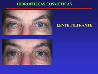 HIDROFÍLICAS COSMÉTICAS
LENTE FILTRANTE
 