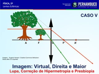 FÍSICA, 2º
Lentes Esféricas

CASO V

A

F

O

F’

A’

Imagem: Eugenio Hansen / Creative Commons AttributionShare Alike 3.0 Unported.

Imagem: Virtual, Direita e Maior

Lupa, Correção de Hipermetropia e Presbiopia

 