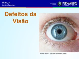 FÍSICA, 2º
Lentes Esféricas

Defeitos da
Visão

Imagem: 8thstar / GNU Free Documentation License

 