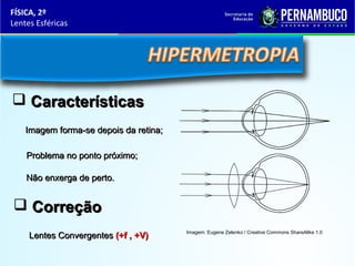 FÍSICA, 2º
Lentes Esféricas

 Características
Imagem forma-se depois da retina;
Problema no ponto próximo;
Não enxerga de perto.

 Correção
Lentes Convergentes (+f , +V)

Imagem: Eugene Zelenko / Creative Commons ShareAlike 1.0

 