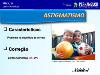 FÍSICA, 2º
Lentes Esféricas

 Características
Problema na superfície da córnea.

 Correção
Lentes Cilíndricas (±f , ±V)
Imagem: Governo Federal dos EUA / Public Domain.

Normal
3 2 di
1
di

 