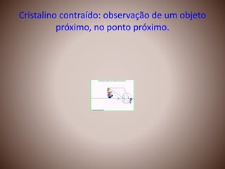 Cristalino contraído: observação de um objeto
próximo, no ponto próximo.
 