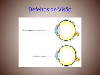 Defeitos de Visão
 