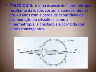 • Presbiopia: é uma espécie de hipermetropia
resultante da idade, costuma aparecer depois
dos 40 anos com a perda de capacidade de
acomodação do cristalino, como a
hipermetropia, a presbiopia é corrigida com
lentes convergentes.
 