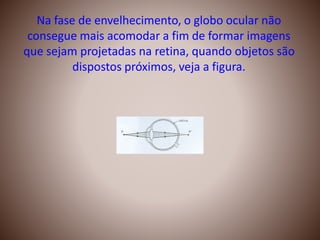 Na fase de envelhecimento, o globo ocular não
consegue mais acomodar a fim de formar imagens
que sejam projetadas na retina, quando objetos são
dispostos próximos, veja a figura.
 