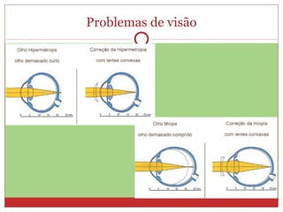 Problemas de visão
 