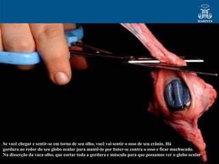 Se você chegar e sentir-se em torno de seu olho, você vai sentir o osso de seu crânio. Há
gordura ao redor do seu globo ocular para mantê-lo por bater-se contra o osso e ficar machucado.
Na dissecção da vaca olho, que cortar toda a gordura e músculo para que possamos ver o globo ocular
 