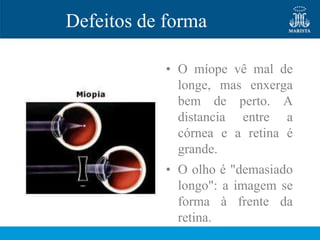 Defeitos de forma

            • O míope vê mal de
              longe, mas enxerga
              bem de perto. A
              distancia entre a
              córnea e a retina é
              grande.
            • O olho é "demasiado
              longo": a imagem se
              forma à frente da
              retina.
 