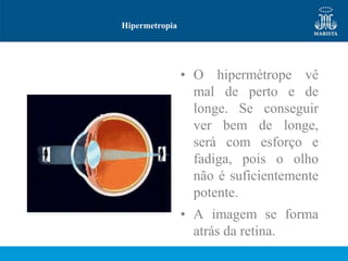 Hipermetropia




                • O hipermétrope vê
                  mal de perto e de
                  longe. Se conseguir
                  ver bem de longe,
                  será com esforço e
                  fadiga, pois o olho
                  não é suficientemente
                  potente.
                • A imagem se forma
                  atrás da retina.
 