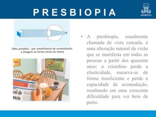 PRESBIOPIA

     • A presbiopia, usualmente
       chamada de vista cansada, é
       uma alteração natural da visão
       que se manifesta em todas as
       pessoas a partir dos quarenta
       anos: o cristalino perde a
       elasticidade, encurva-se de
       forma insuficiente e perde a
       capacidade de acomodação,
       resultando em uma crescente
       dificuldade para ver bem de
       perto.
 