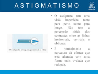 ASTIGMATISMO
      • O astigmata tem uma
        visão imperfeita, tanto
        para perto como para
        longe.    Não     tem    a
        percepção    nítida    dos
        contrastes entre as linhas
        horizontais, verticais e
        obliquas.
      • É      normalmente    a
        curvatura da córnea que
        está alterada com uma
        forma mais ovalada que
        redonda.
 