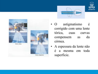 • O      astigmatismo      é
  corrigido com uma lente
  tórica,    cuas     curvas
  compensem        as     da
  córnea.
• A espessura da lente não
  é a mesma em toda
  superfície.
 