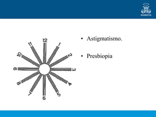 • Astigmatismo.

• Presbiopia
 