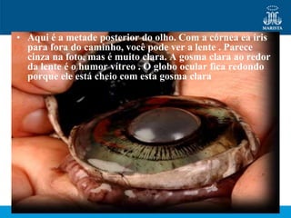 • Aqui é a metade posterior do olho. Com a córnea ea íris
  para fora do caminho, você pode ver a lente . Parece
  cinza na foto, mas é muito clara. A gosma clara ao redor
  da lente é o humor vítreo . O globo ocular fica redondo
  porque ele está cheio com esta gosma clara
 