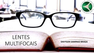 LENTES
MULTIFOCAIS DAVYSON SAMPAIO BRAGA
 