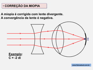 • CORREÇÃO DA MIOPIA

A miopia é corrigida com lente divergente.
A convergência da lente é negativa.




                                                               I



     Exemplo:
     C = -2 di

                                             www.fisicaatual.com.br
 