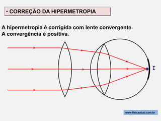 • CORREÇÃO DA HIPERMETROPIA

A hipermetropia é corrigida com lente convergente.
A convergência é positiva.




                                                                   I




                                               www.fisicaatual.com.br
 