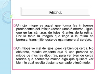 Foco principal: Es el punto, perteneciente al eje principal, por donde pasan todos los rayos refractados que inciden en la lente en forma paralela al eje principal.Plano principal: Es el plano perpendicular al eje principal que pasa por el centro óptico.