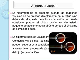 Espejo Parabólico Delgado.Espejos PoligonalesSe denomina espejo poligonal a una superficie reflectora formada por la colocación en forma de polígono de una serie de espejos planos.