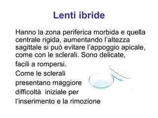 Lenti a contatto morbide e cheratocono