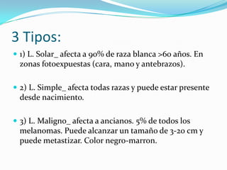 3 Tipos:
1) L. Solar_ afecta a 90% de raza blanca >60 años. En
zonas fotoexpuestas (cara, mano y antebrazos).
2) L. Simple_ afecta todas razas y puede estar presente
desde nacimiento.
3) L. Maligno_ afecta a ancianos. 5% de todos los
melanomas. Puede alcanzar un tamaño de 3-20 cm y
puede metastizar. Color negro-marron.