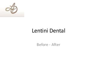 Lentini Dental
Before - After
 