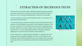 EXODONTIA final.pptx presentation surgery | PPTX