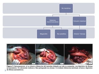 No mecánica
Defectos
neuromusculares
Megacolón Íleo paralítico
Oclusión intestinal
Arterial / Venosa
 