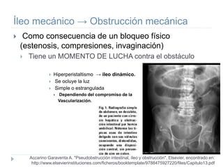Íleo mecánico → Obstrucción mecánica
 Como consecuencia de un bloqueo físico
(estenosis, compresiones, invaginación)
 Tiene un MOMENTO DE LUCHA contra el obstáculo
 Hiperperistaltismo → íleo dinámico.
 Se ocluye la luz
 Simple o estrangulada
 Dependiendo del compromiso de la
Vascularización.
Accarino Garaventa A. "Pseudobstrucción intestinal, íleo y obstrucción". Elsevier, encontrado en:
http://www.elsevierinstituciones.com/ficheros/booktemplate/9788475927220/files/Capitulo13.pdf
 
