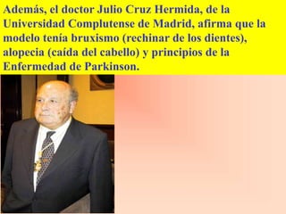 Además, el doctor Julio Cruz Hermida, de la
Universidad Complutense de Madrid, afirma que la
modelo tenía bruxismo (rechinar de los dientes),
alopecia (caída del cabello) y principios de la
Enfermedad de Parkinson.
 