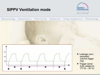 SIPPV Ventilation mode    Leakage com-   pensated    volume trigge-   ring    Trigger sensi-   tivity related to    VTi (5 – 30 %) 