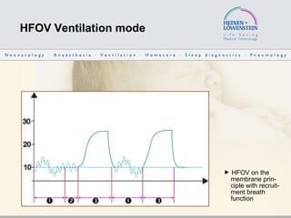 HFOV Ventilation mode    HFOV on the    membrane prin-   ciple with recruit-   ment breath    function 