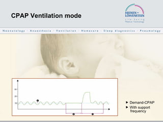 CPAP Ventilation mode    Demand-CPAP    With support    frequency 
