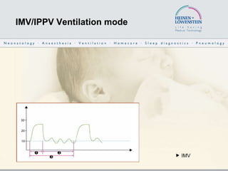 IMV/IPPV Ventilation mode    IMV 