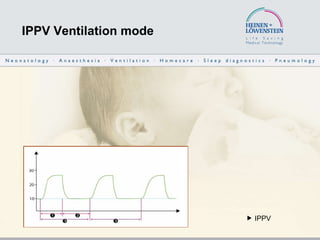 IPPV Ventilation mode    I PPV 