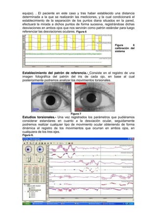 equipo). . El paciente en este caso y tras haber establecido una distancia
determinada a la que se realizarán las mediciones, y la cual condicionará el
establecimiento de la separación de los puntos diana situados en la pared,
efectuará la mirada a dichos puntos de forma sucesiva, registrándose dichas
desviaciones en ambos ojos que nos servirán como patrón estándar para luego
referenciar las desviaciones oculares. Figura 6



                                                              Figura        6
                                                              calibración del
                                                              sistema




Establecimiento del patrón de referencia.- Consiste en el registro de una
imagen fotográfica del patrón del iris de cada ojo, en base al cual
posteriormente podremos analizar los movimientos torsionales.




                                Figura 7
Estudios torsionales.- Una vez registrados los parámetros que pudiéramos
considerar estandares en cuanto a la desviación ocular, seguidamente
podremos realizar cualquier tipo de movimiento ocular obteniendo de forma
dinámica el registro de los movimientos que ocurran en ambos ojos, en
cualquiera de los tres ejes.
Figura 8.
 
