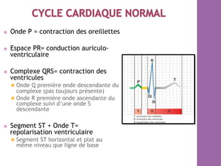 ⦿  Onde P = contraction des oreillettes
⦿  Espace PR= conduction auriculo-
ventriculaire
⦿  Complexe QRS= contraction des
ventricules
  Onde Q première onde descendante du
complexe (pas toujours présente)
  Onde R première onde ascendante du
complexe suivi d’une onde S
descendante
⦿  Segment ST + Onde T=
repolarisation ventriculaire
  Segment ST horizontal et plat au
même niveau que ligne de base
 